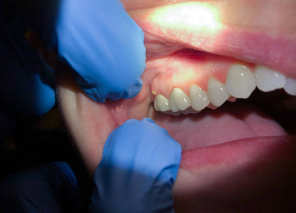 Best Emergency TMJ Treatment in Elk River, MN